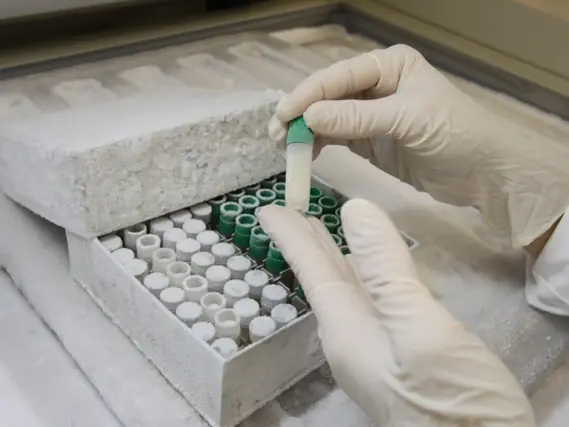 Preservação de amostras por ultracongelamento