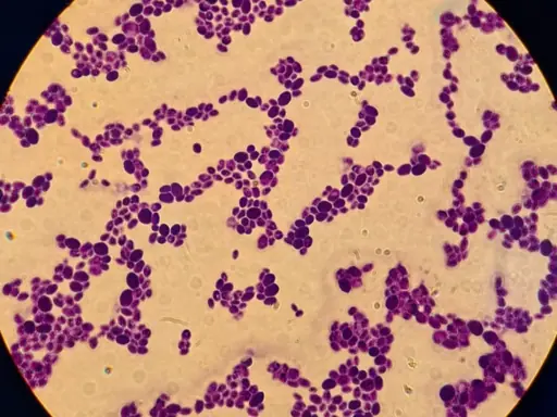 Lâmina de Gram de Lodderomyces parapsilosis