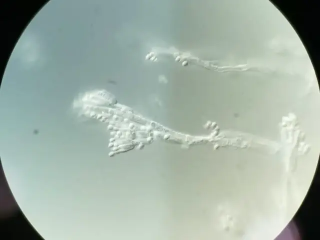 Conidióforo de Penicillium spp.